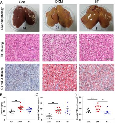 Protective effects of betaine on the early fatty liver in laying hens through ameliorating lipid metabolism and oxidative stress